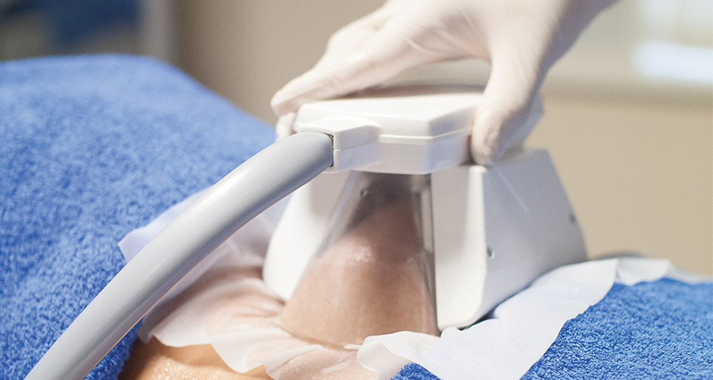 How Fat Freezing and HIFU Work Together? 2 Multiple Areas in One Session HIFU and Fat Freezing Coalville