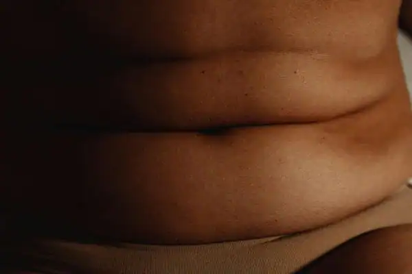 The Hidden Connection: How Stress Shapes Your Fitness and Body Composition 3 image of what stress can do on the stomach area and how Lipo 360 Coalville can help to change your body shape.